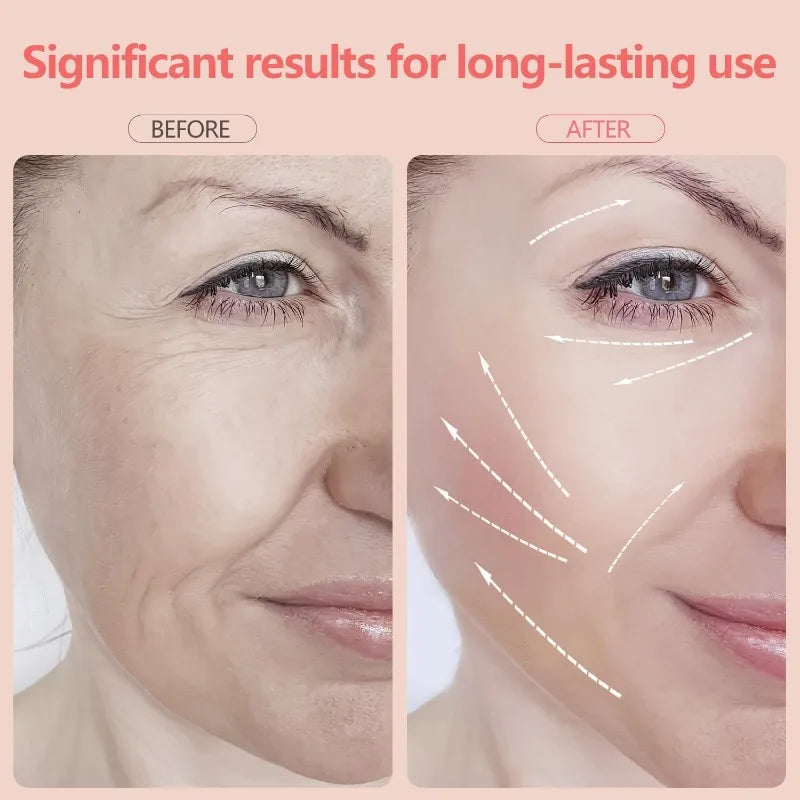 3 Beauty Modes USB Rechargeable Facial Wrinkle and Anti-aging Skin Care Tool Handheld 7-color Facial Therapy Beauty Device With