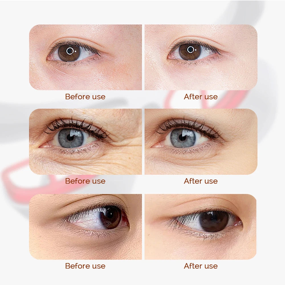 Eye Massager 3 Gear Red light Remove Eye Bags Dark Circles Puffiness Hot Compress Eye Relieve Eye Fatigue Wireless Use
